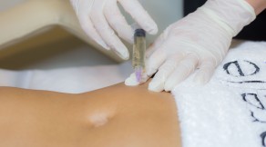 Mesotherapy